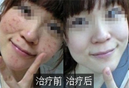 ɹ-ذ.jpg